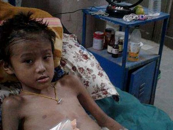 Help this 8 year old brave boy from losing his leg to gangrene