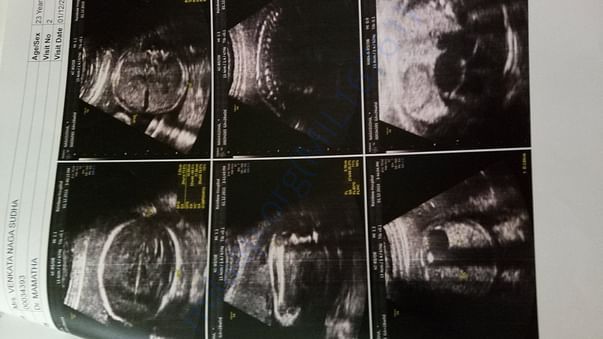ULTRASONOGRAPHY AT THE AGE 1MONTH