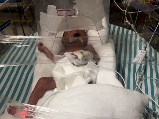 Help Baby Of Romana Parvin Get NICU Treatment