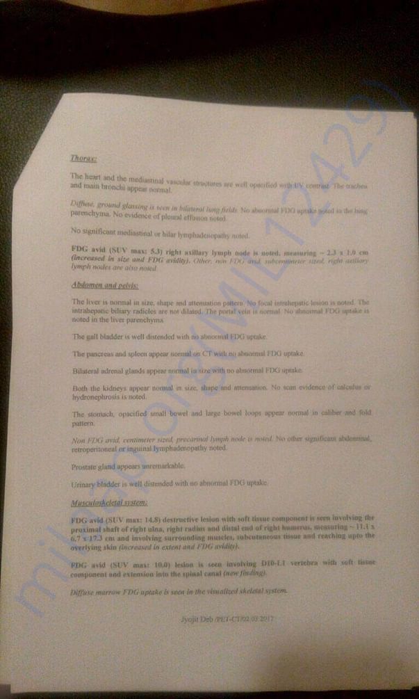 PET CT Scan Page 2