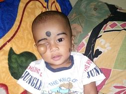 This 10-month-old's Survival Depends On An Open Heart Surgery