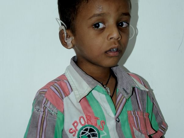 This Little Boy Has Not Heard Or Spoken A Word Since His Birth