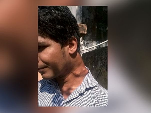 Save Rameez Khan From Paralysis