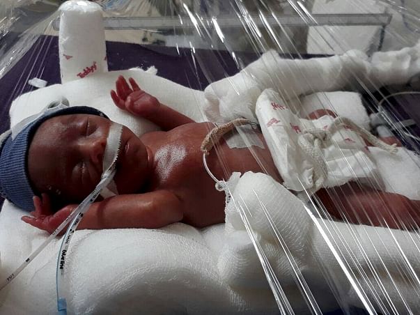 Please Save My One-month-old Baby Boy