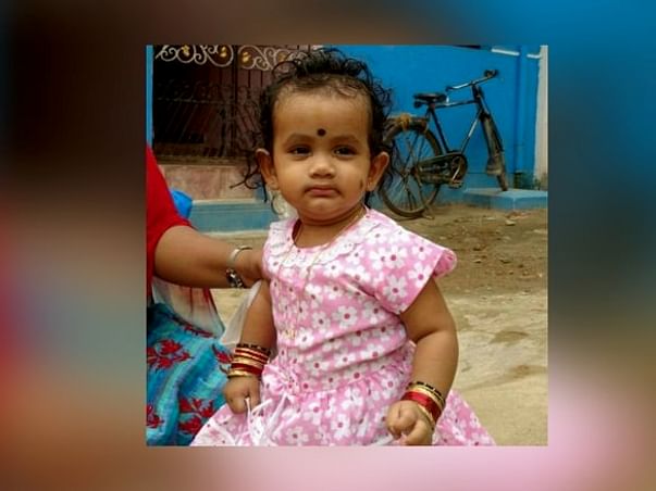 Save Baby Akshaya From Severe Scald Burns