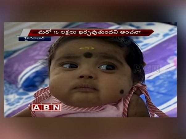 Help Siva Save His 4-Month-Old Baby Girl From HLH Disease