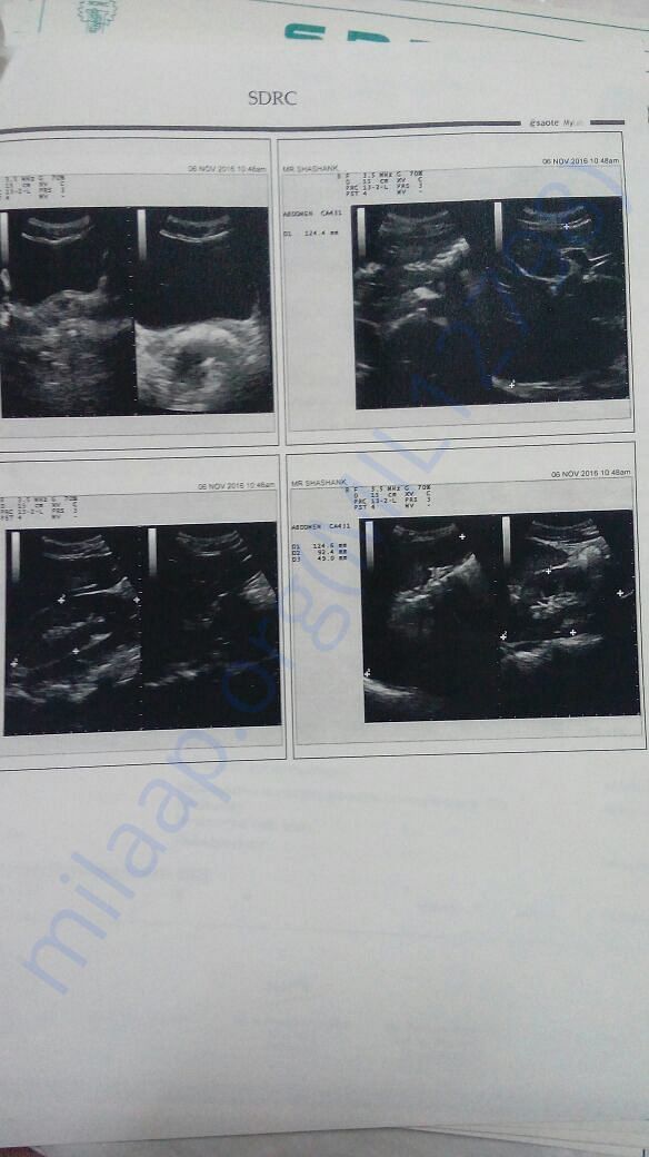 2 MRI Scan Of Spinal chord