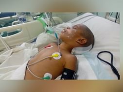 Save 5-Year-Old Jitender From Brain Clot