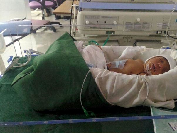 This 11-day-Old Baby Needs Our Help To Stay Alive