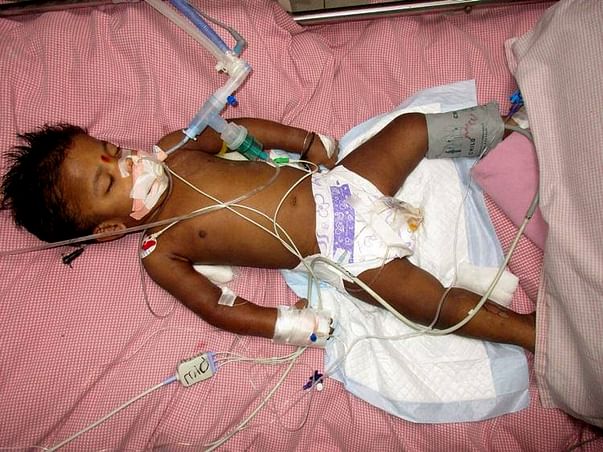 Help my 2-year-old fight Acute Encephalopathy