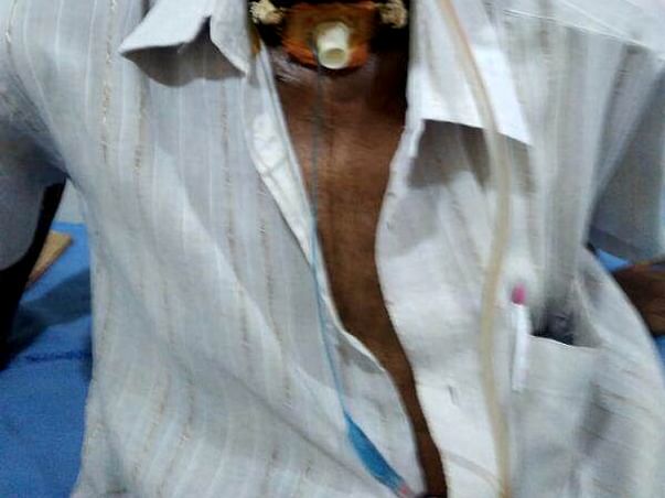 Help Narasa Reddy Afford Treatment for Throat Cancer