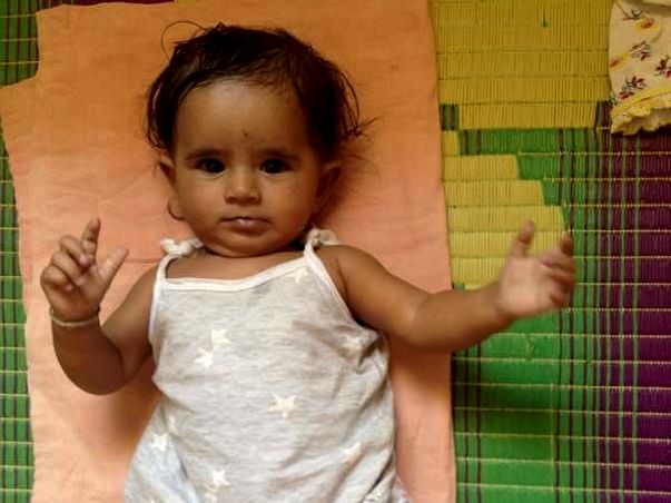 Fund Raising For Congenital Heart Surgery Of Child