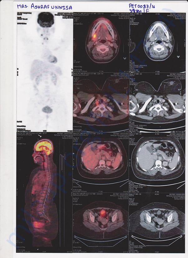 Pet Scan Report