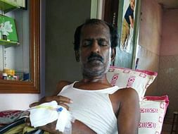 He Has No Stomach Because Of Cancer, Now It Is Attacking His Bones