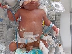 Help Asma's Premie Baby Get More Time To Fight And Survive