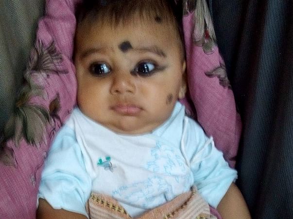 This 4-month-old Baby Is Fighting Cancer Of Nerve Cells To Stay Alive
