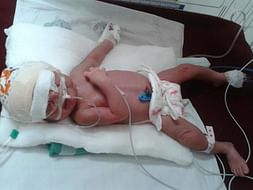 Please help my 1-week-old baby fighting for his life