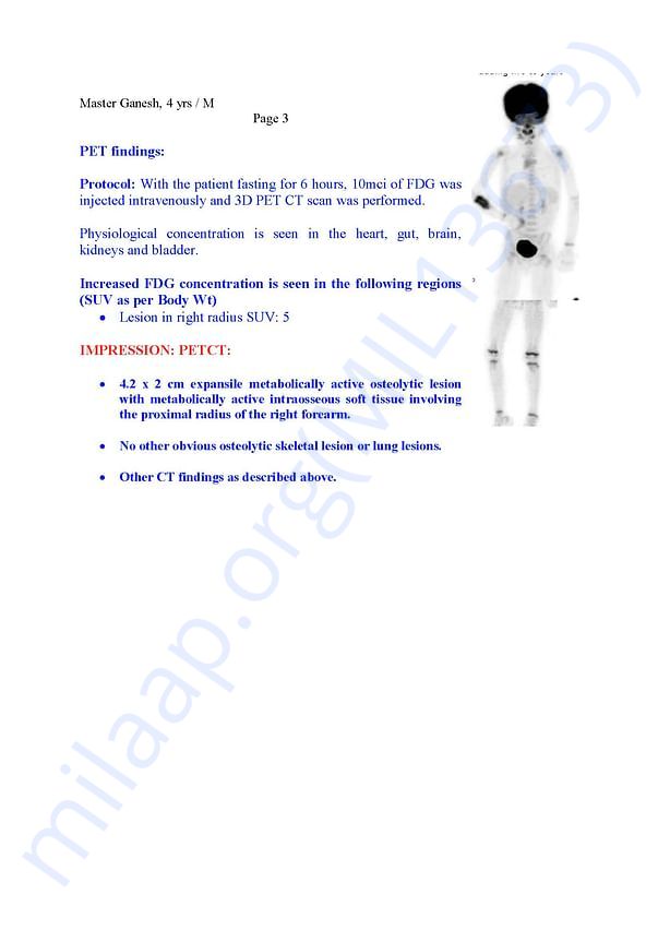 PET DOCUMENT POST CHEMOTHERAPY
