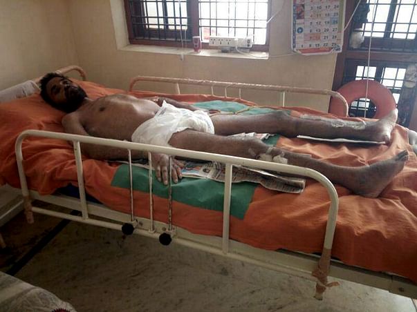 Help Bhanu fight full paralysis(neck-down) due to Spinal Cord fusion