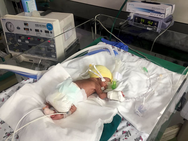 Her Premie Twins Are Struggling To Live And She Has Noone For Support