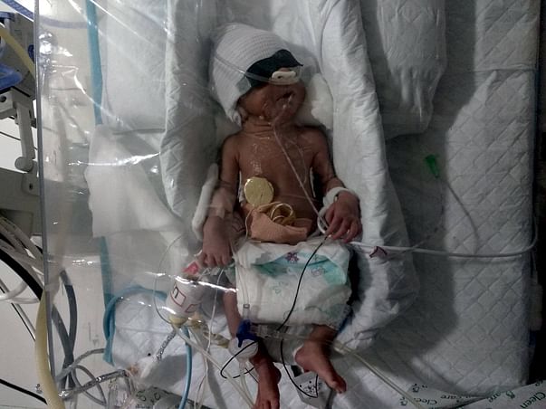 Nilam's New-Born Twins Need Your Help Funding Their Treatment