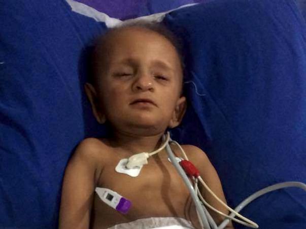 My 2 year 0ld son suffering from kidney cancer
