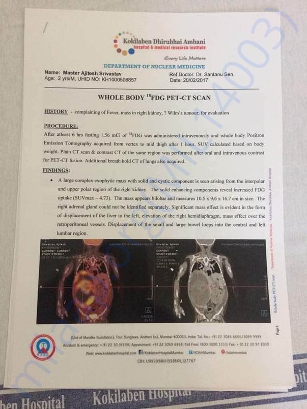 PET SCAN Report