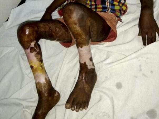 HELP BABY KARAN RECOVER FROM HIS PAIN!