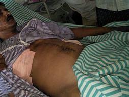 Help Srinivas Undergo MDCT Chest Surgery