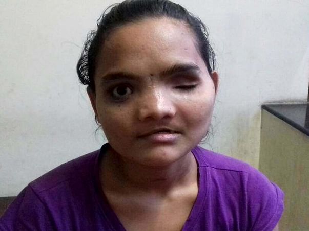 Help Vaishali get an operation that helps her eat and see again