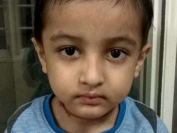Help Baby Boy Manav Thakor For Bone Marrow Transplant