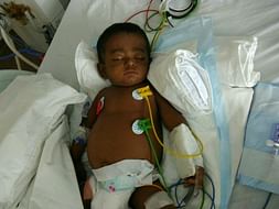 Help 1-year-old Aswin undergo an urgent liver transplant
