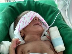 These New Born Twins Are In ICU- Save Them