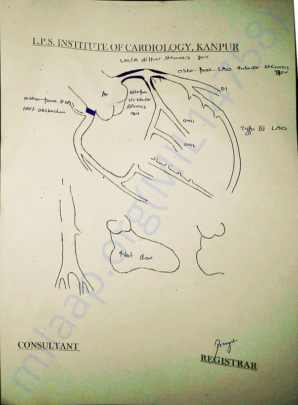 Image of the heart generated in angiography report