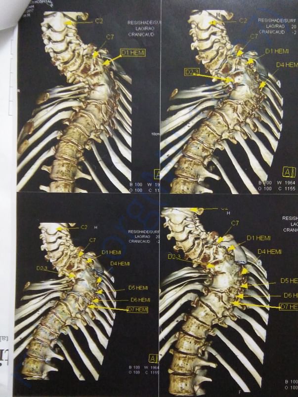 CT scan reports