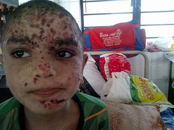 Thanseeh Can Overcome This Terrible Disease With Your Support