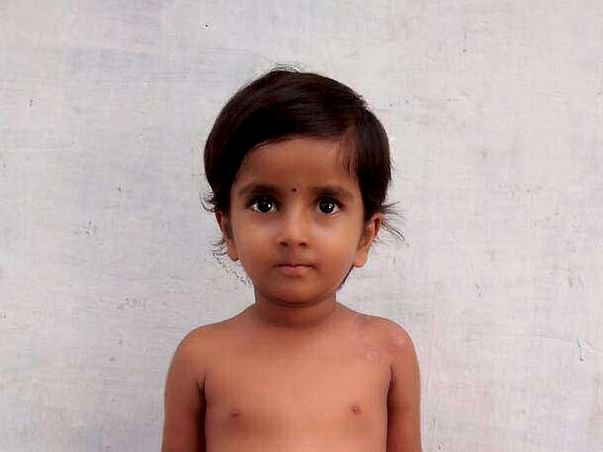 Help my daughter for liver transplantation