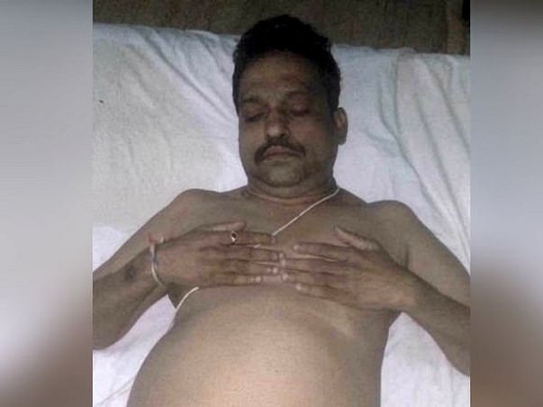 Please Help Me Raise Funds For My Father's Liver Transplantation