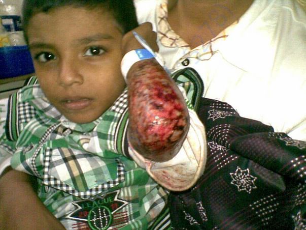 from hospital