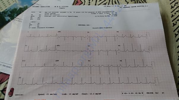 ECG
