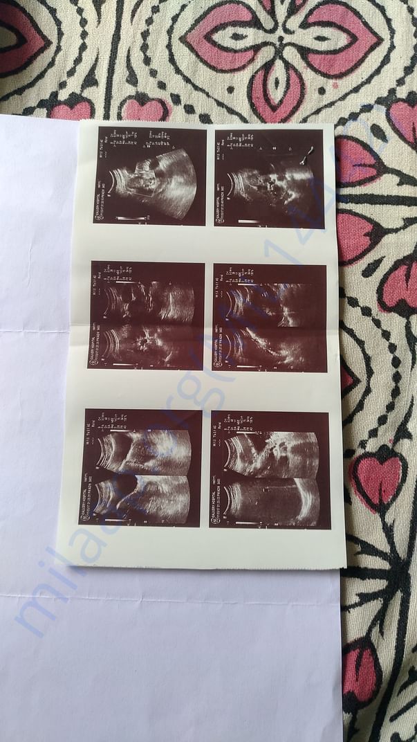 ultrasound report