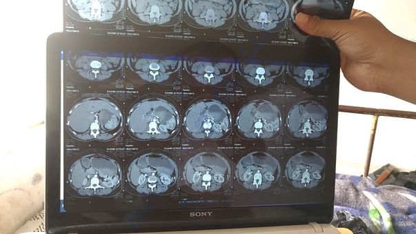 CT scan