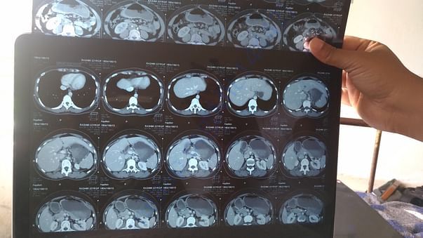 CT scan