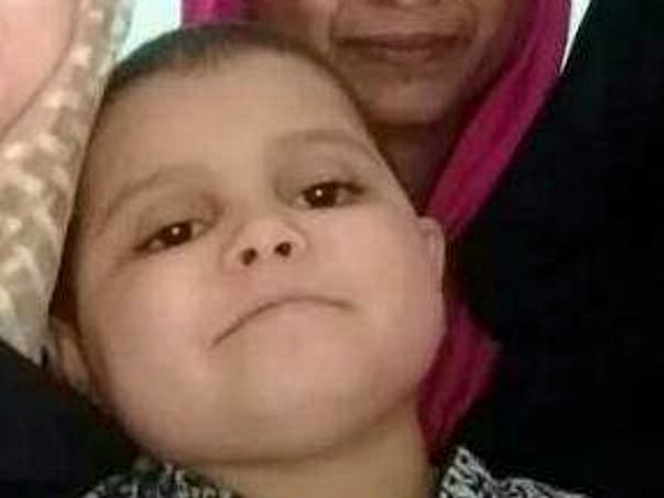 Help Ayesha Fight Suprasellar Meningioma