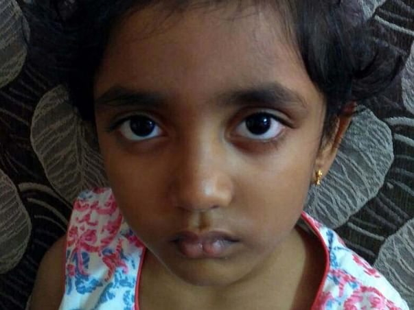 At 5, She Has No Idea What Cancer Is; But She Is Fighting It Bravely.