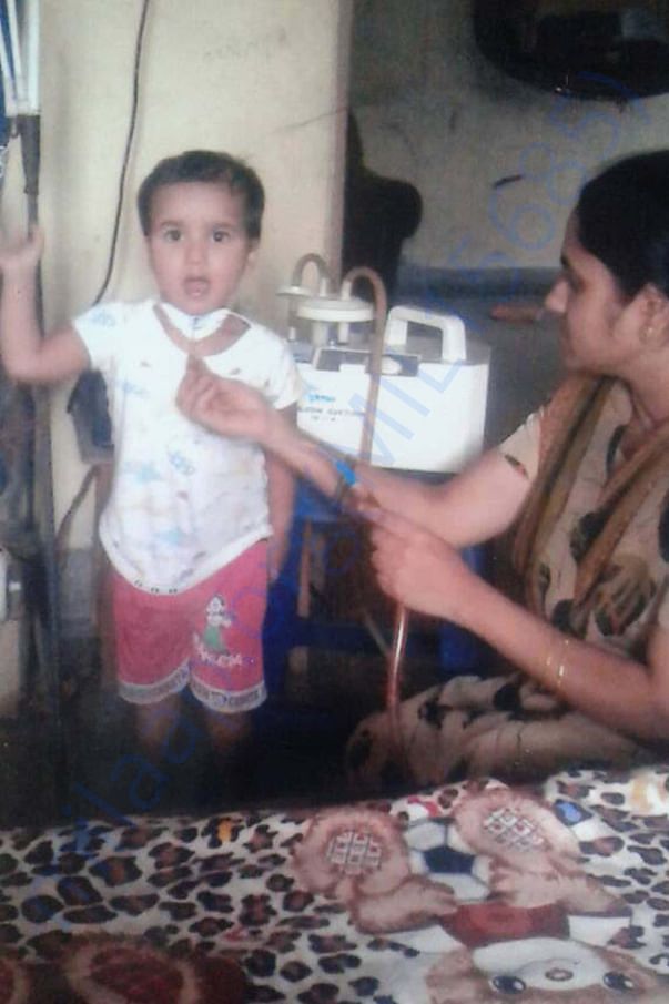 Removing secretions image of patient S. Jathin Raj and his mon saritha
