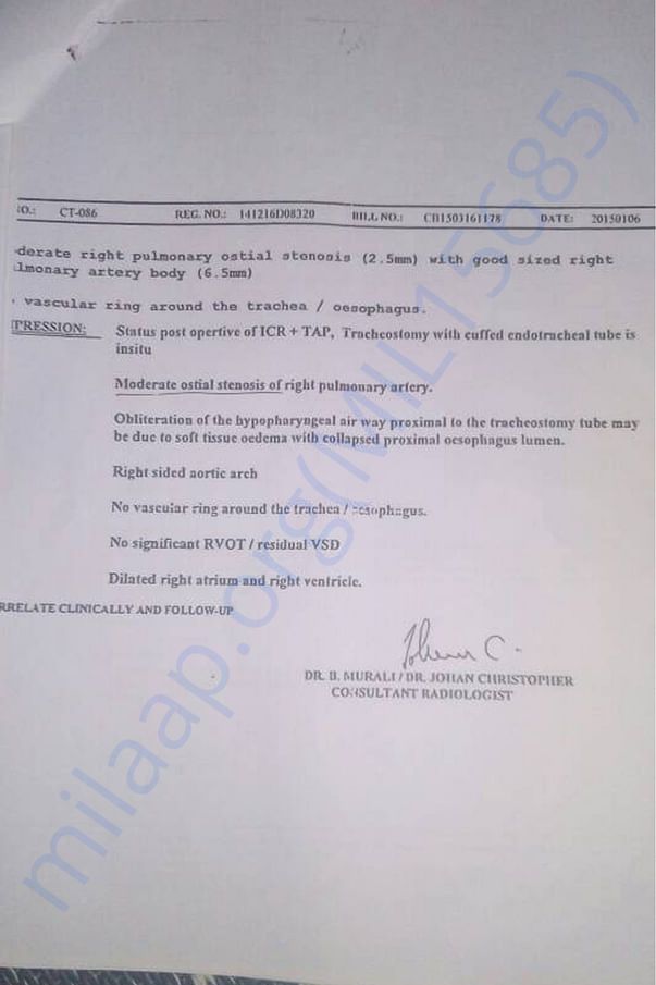 Status post operative of ICR+TAP, Trachestomy with cuffed endotrachea