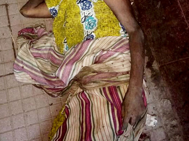 On Hospital's Death Bed With A Head Full Of Maggots, Please Save Her