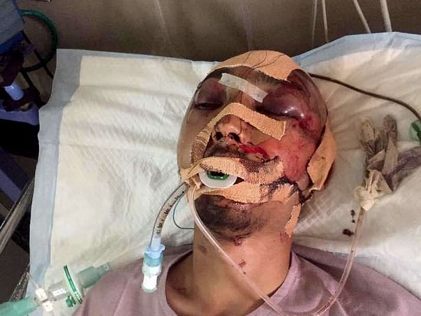 Help Darshan Recover From A Serious Accident