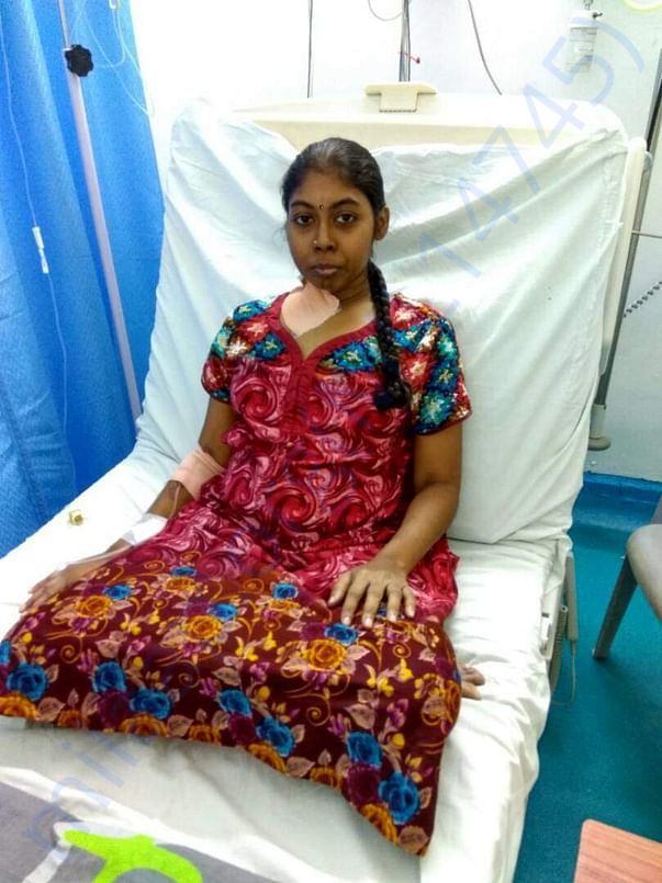 Devi during her 1st chemo - May 2017